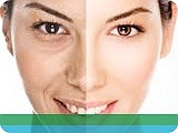 Anti-wrinkle